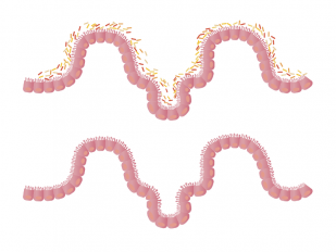 intestines-1468807_1280.png